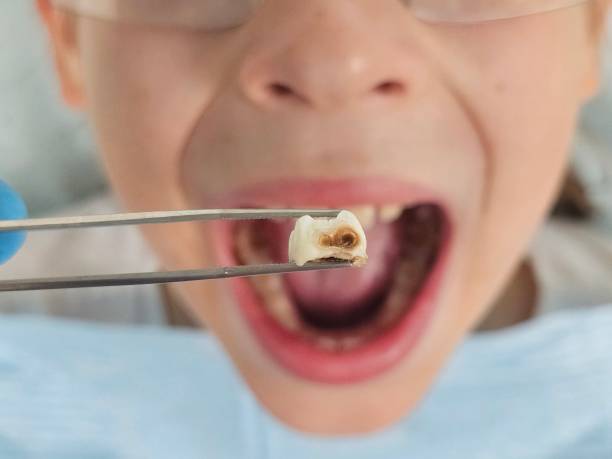 Best Weekend Emergency Dentist in Manson, IA